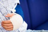 Fractures-image