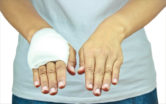 New York Burn Injury Attorney