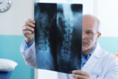 Delayed Benign Spinal Tumor Attorneys