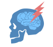 A TBI is 