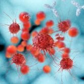 Picture of cervical cancer