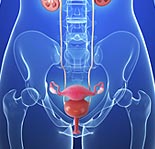 Bladder Cancer Diagram