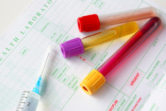 Vulvar Cancer Lap Test Picture
