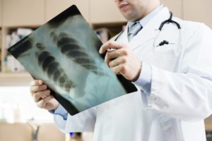 Doctor checking on x-ray results.
